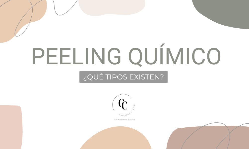 tipos de peeling químico que te puedes realizar